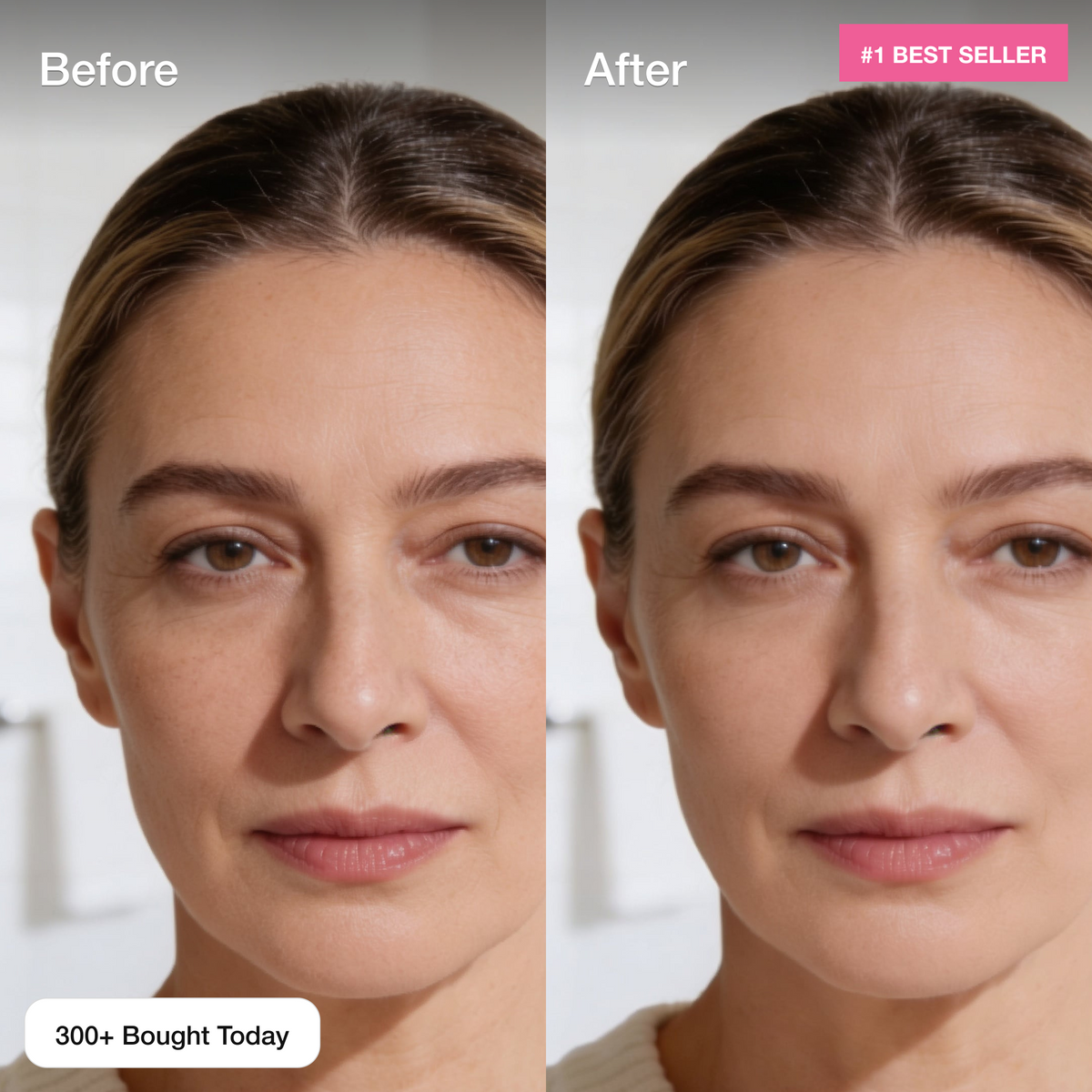 Under-Eye Lift Patches for Dark Circles & Puffiness