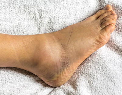 Your ankles disappear into "kankles" by the end of the day.