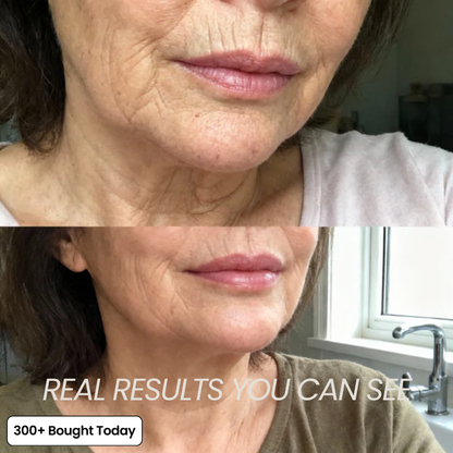 Collagen Plump & Repair Volufiline Balm