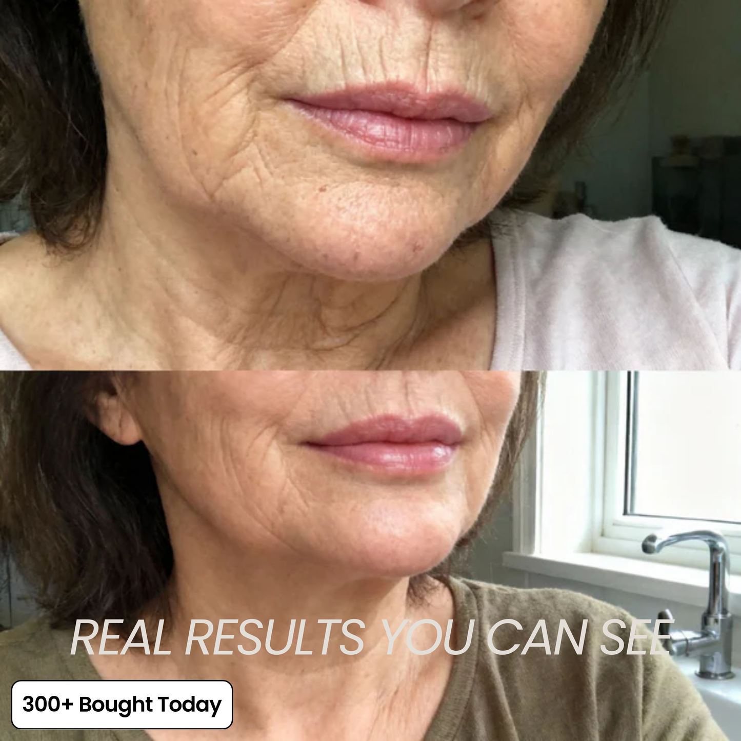 COMPLETE FACE RENEWAL KIT