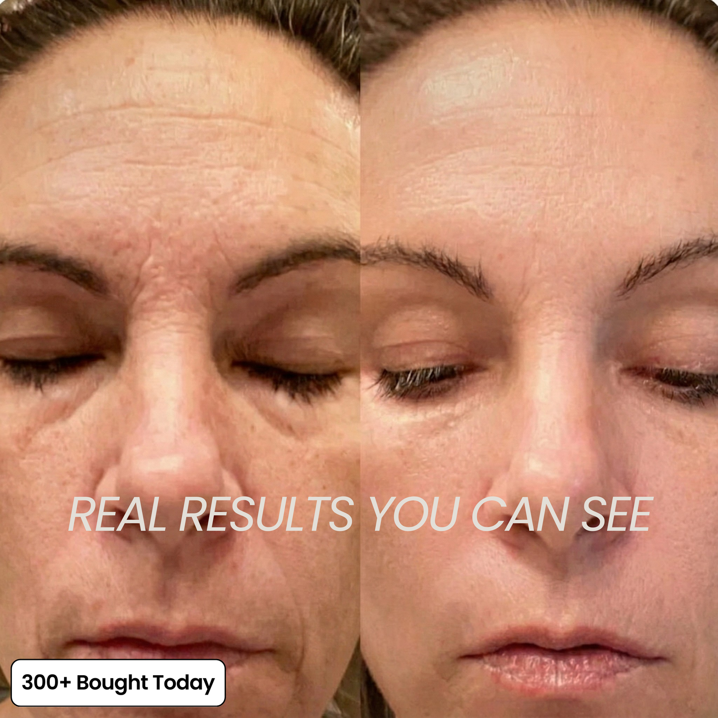 COMPLETE FACE RENEWAL KIT