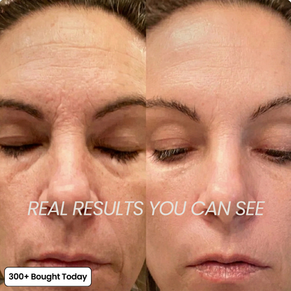 COMPLETE FACE RENEWAL KIT