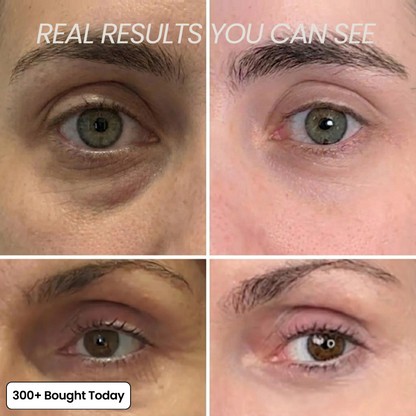 COMPLETE FACE RENEWAL KIT